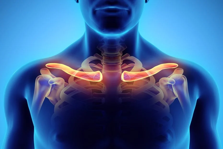 Thoracic Outlet Syndrome: Causes, Symptoms, and Treatment Options